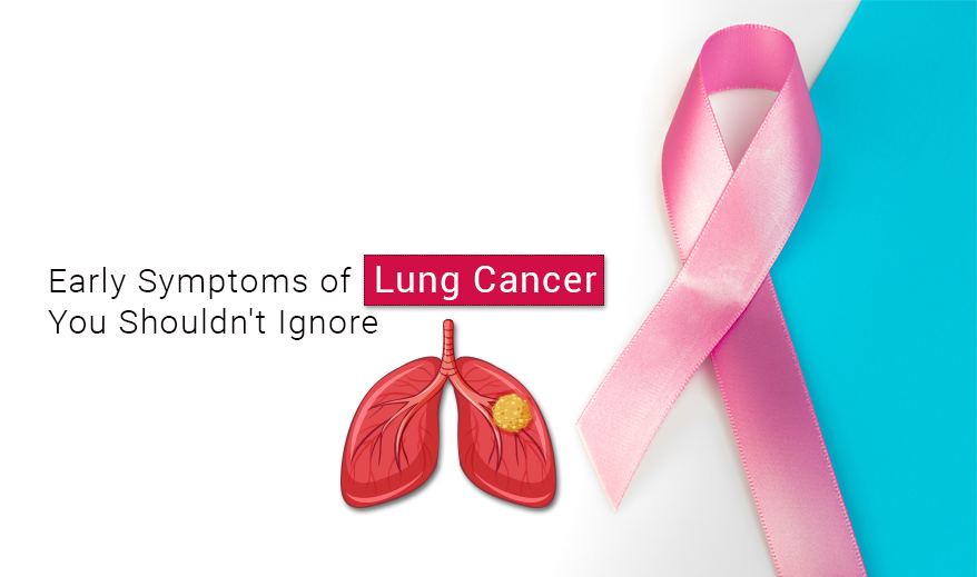Early Symptoms of Lung Cancer You Shouldn't Ignore